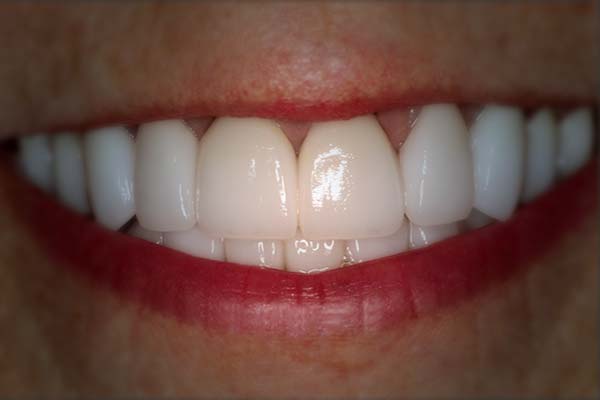restorative dentistry photos