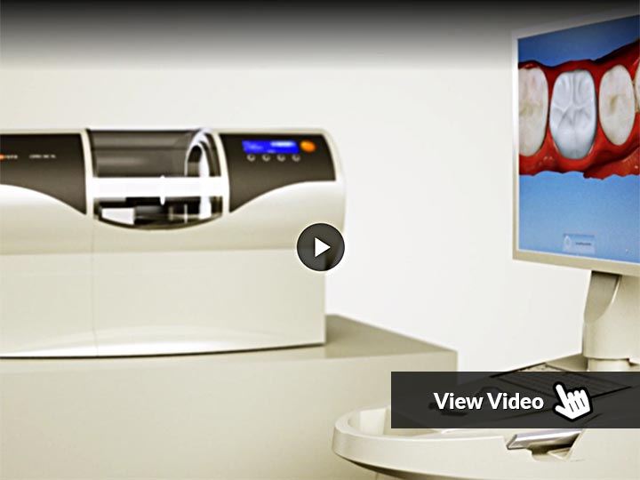 cerec same day dentistry video