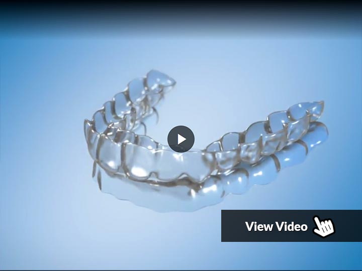 Clear Aligners - Adult